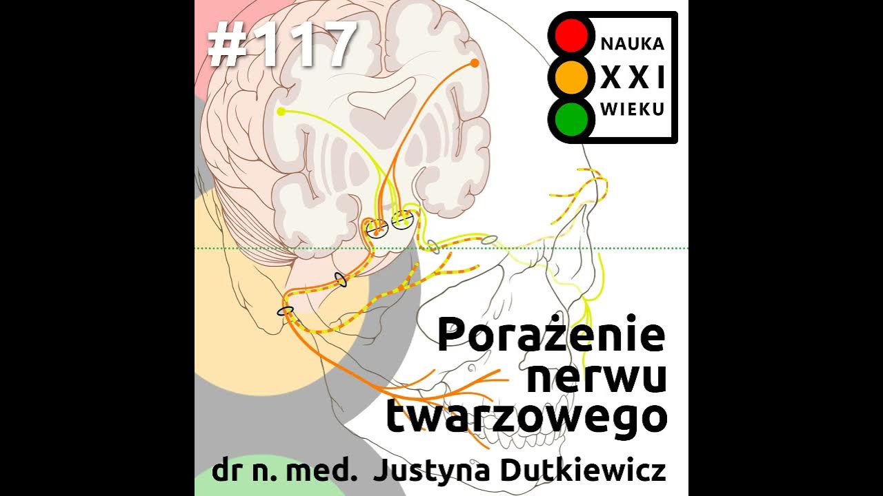 #117 - Porażenie nerwu twarzowego - YouTube Porażenie Nerwu Twarzowego U Dzieci