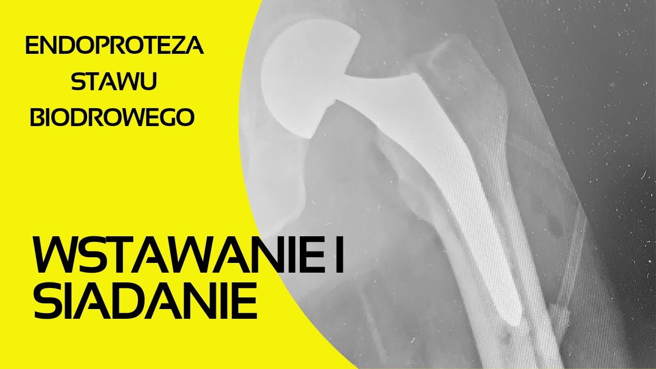 #2 Endoproteza stawu biodrowego - siadanie i wstawanie - YouTube Endoproteza Stawu Biodrowego Opis Przypadku