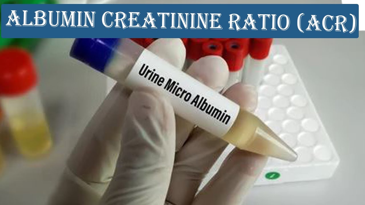 What Is Normal Albumin In Urine