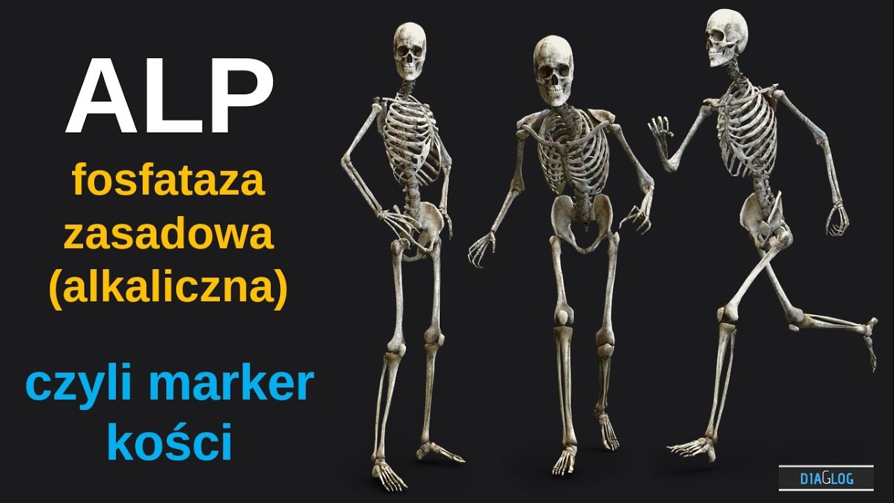 ALP - fosfataza zasadowa alkaliczna - marker kości i dróg żółciowych Fosfataza Zasadowa Podwyższona U Dzieci