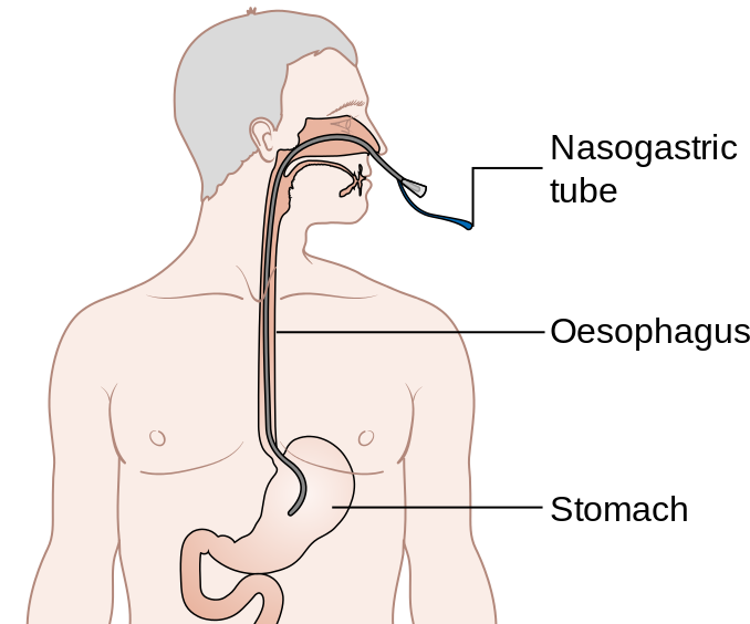 ATI PN Adult Med Surg 2020 with NGN - Naxlex Nursing Pn Adult Medical Surgical Online Practice 2020 B With Ngn