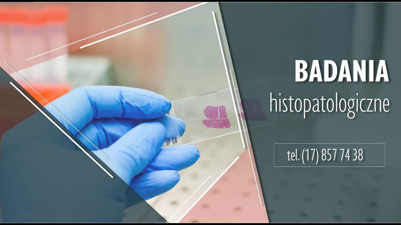 Jak Odczytać Wynik Badania Histopatologicznego