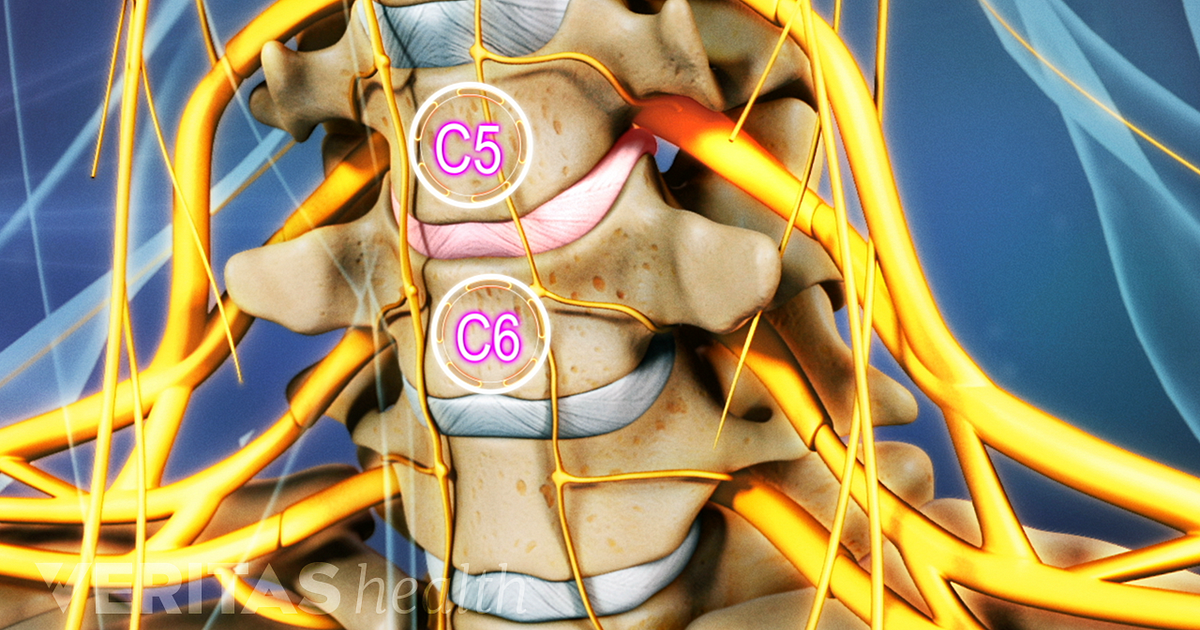 C5-C6 Treatment Wiedźmin 3 żyli Długo I Szczęśliwie