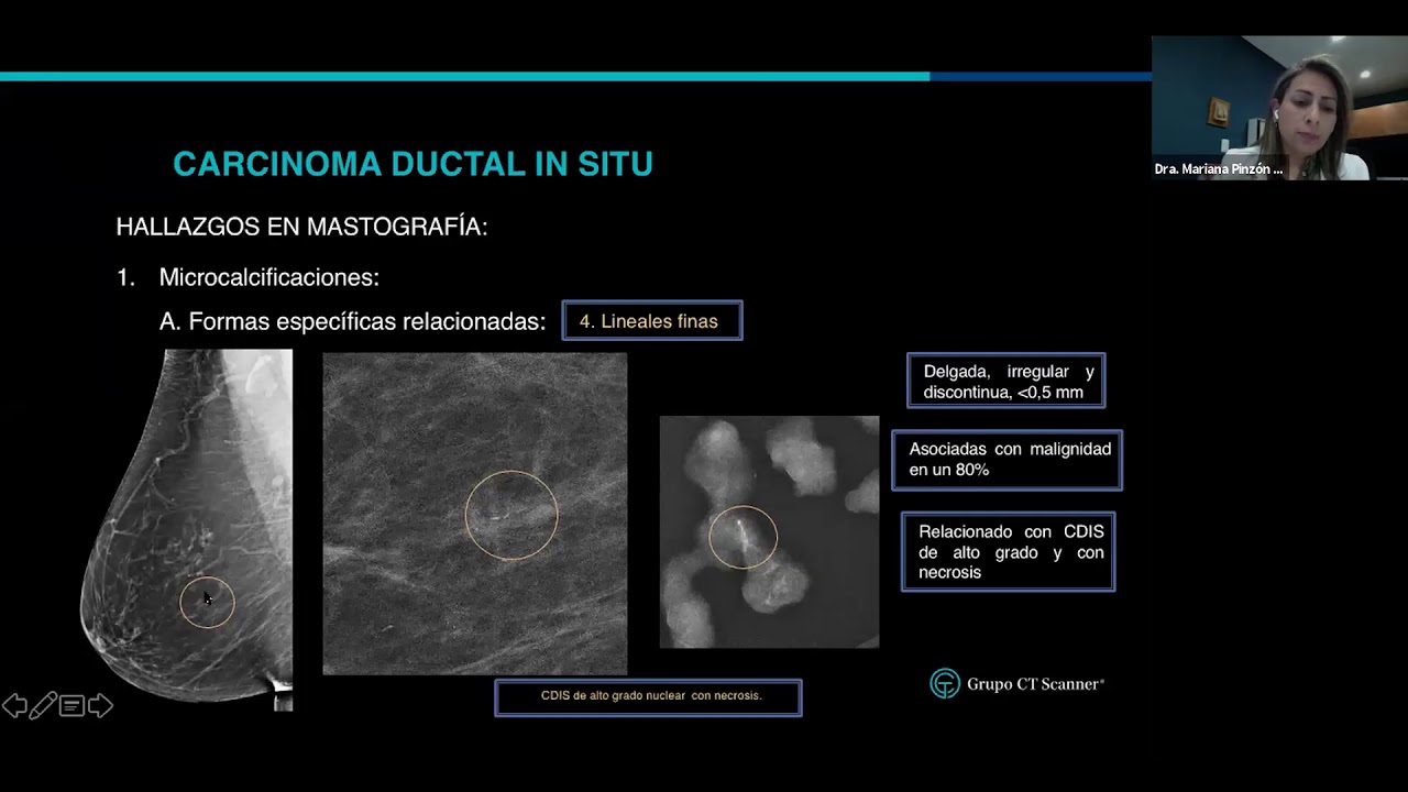 Rak Przewodowy In Situ Dcis G2