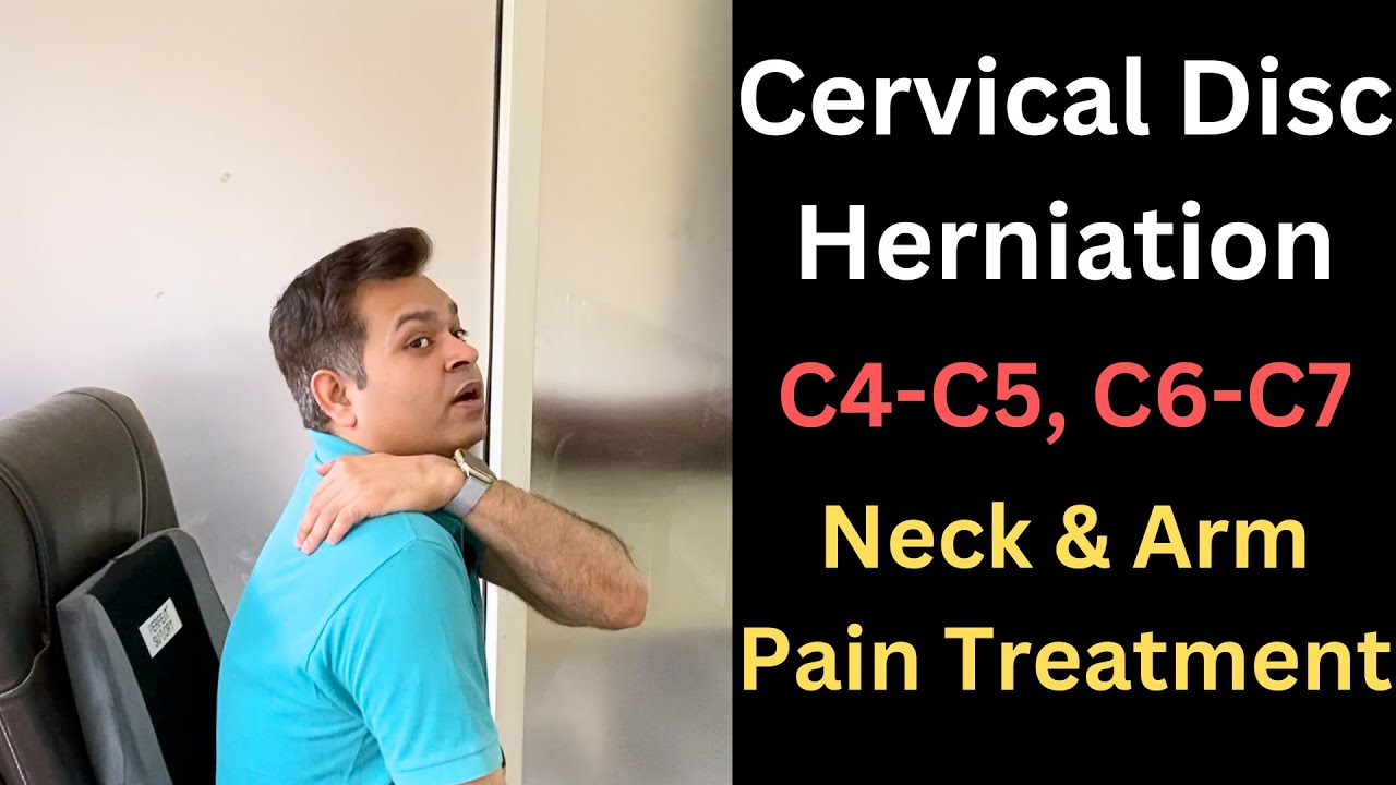 Cervical Disc Herniation, C5-C6, Neck and Arm Pain, Cervical Symptoms Dobrze Się Kłamie W Miłym Towarzystwie Trt Pl