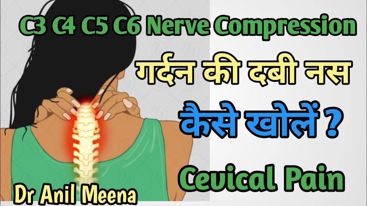 cevical pain relief exercises | C3 C4 C5 C6 nerve compression treatment Chce Cie Zabić Chociaż Pragnę Mieć