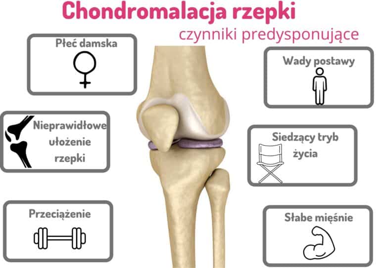 Chondromalacja rzepki - [PORADNIK 2023 - 4 SPOSOBY] Rzepka Typu Iii Wg Wiberga