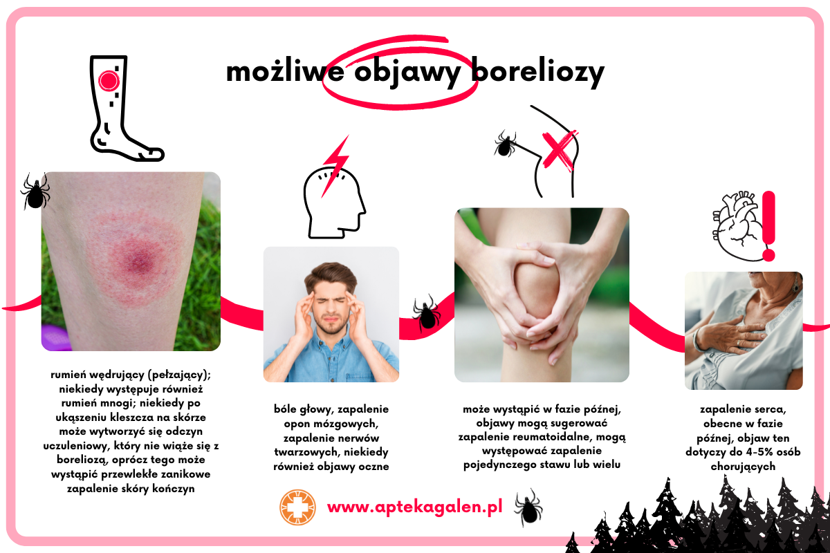 Co to jest borelioza? Objawy, skutki oraz leczenie Jak Odroznic Borelioze Od Rzs