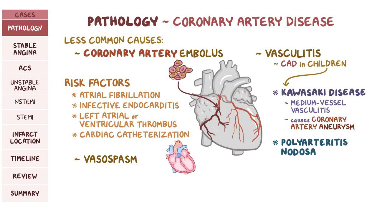 Hesi Case Study Coronary Artery Disease