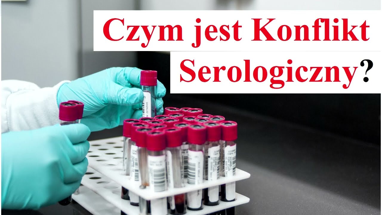 Na Czym Polega Konflikt Rol Spolecznych