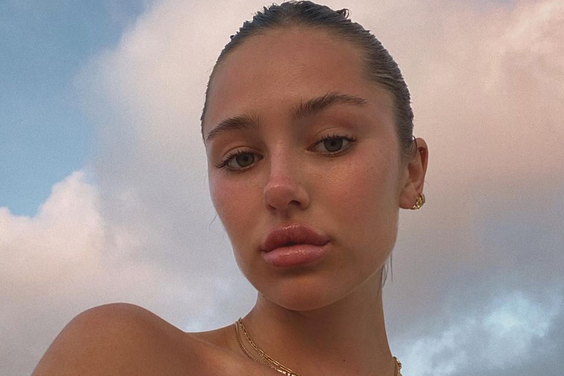 Delilah Belle Hamlin Plastic Surgery