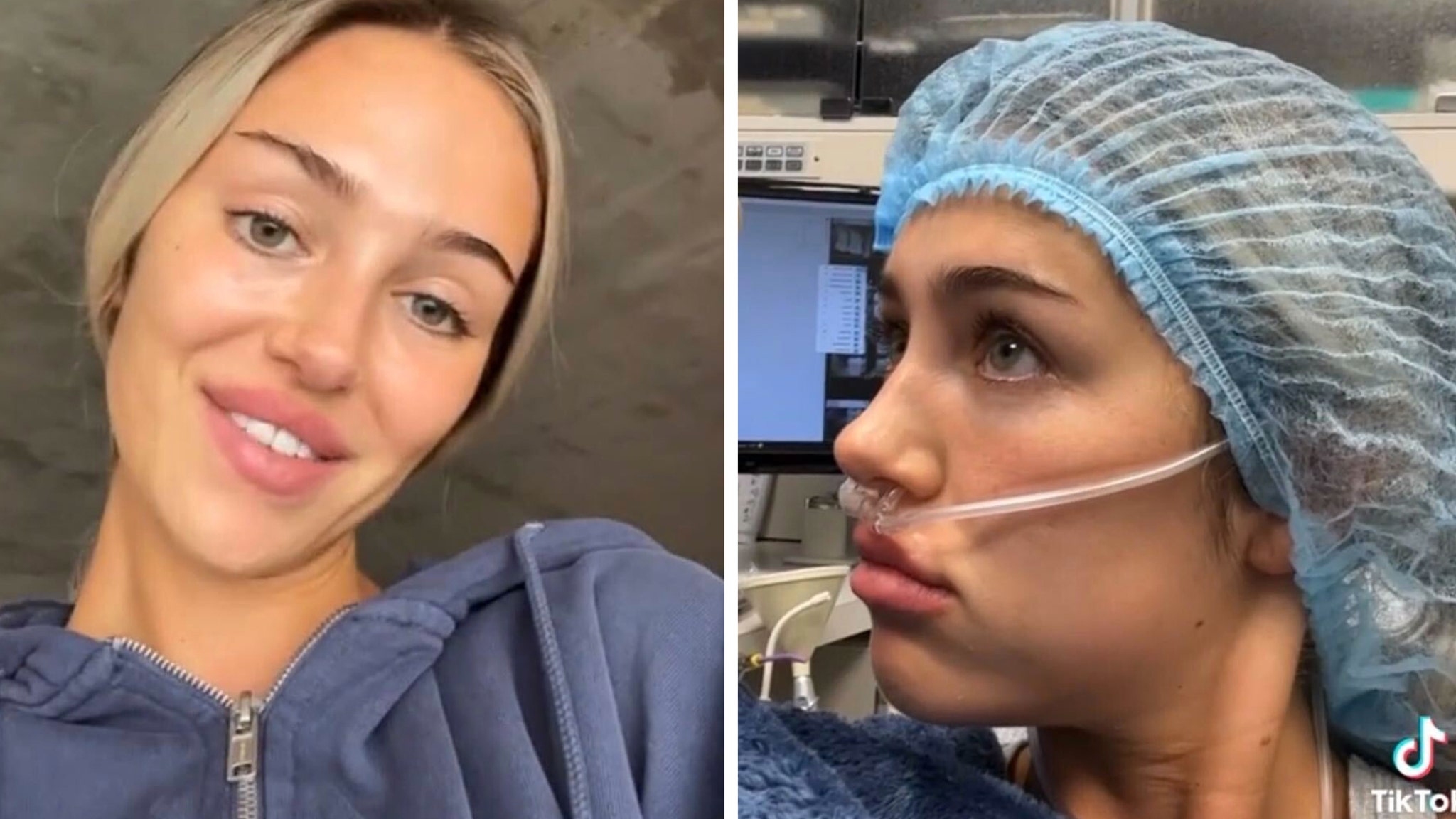 Delilah Hamlin Shares TikTok of Herself Waking Up After Surgery Delilah Belle Hamlin Plastic Surgery