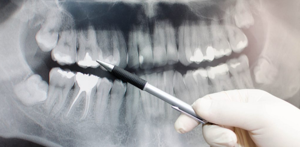 Dental Radiography Chapter 19 Quiz Questions