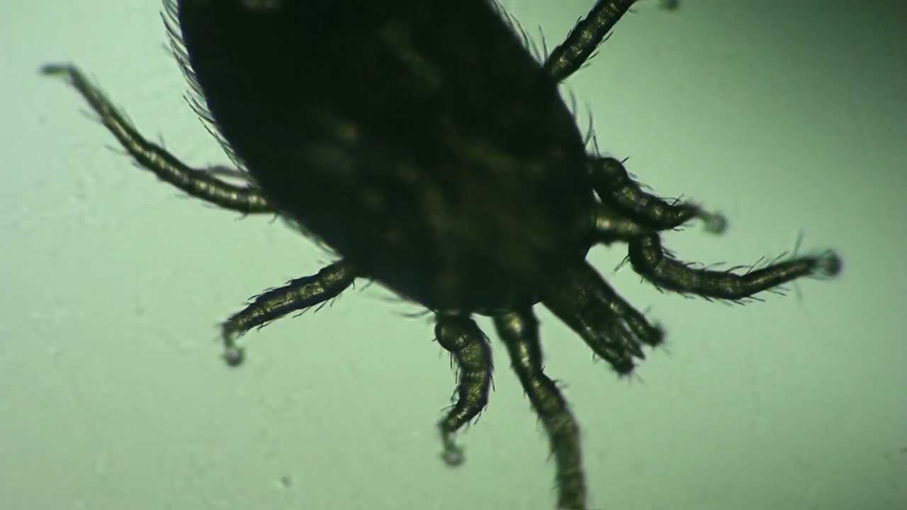 Dermatophagoides Pteronyssinus Co To Jest