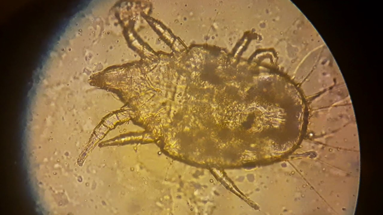Dermatophagoides farinae under Levenhuk 950T Microscope - YouTube Dermatophagoides Farinae Co To Jest