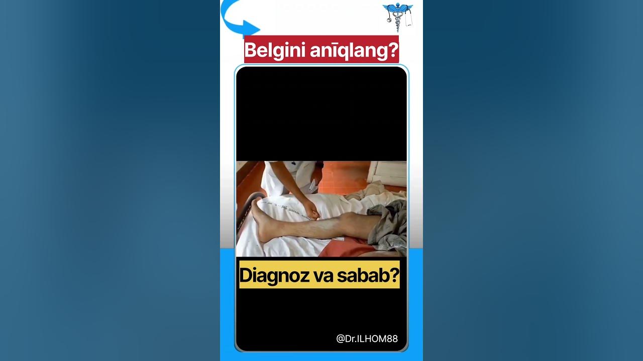 Diagnoz va Sabab? - YouTube Bezrobocie Między Diagnozą A Działaniem