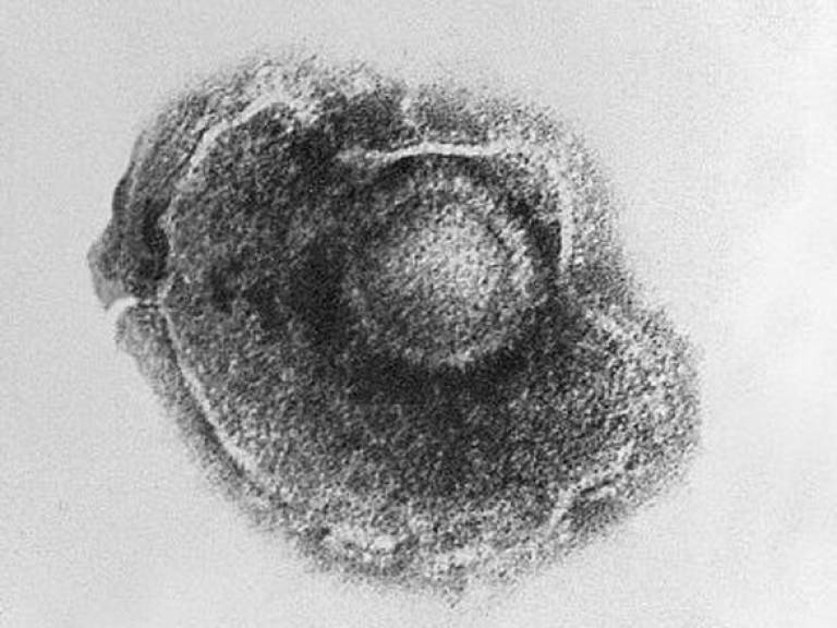 Discovery explains how the chickenpox and shingles virus remains Who Discovered The Varicella Zoster Virus