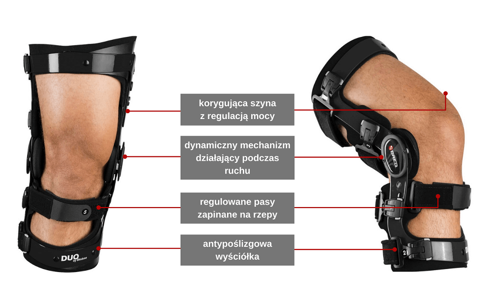 Aparaty Ortopedyczne Na Szpotawe Kolana