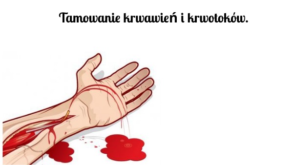 EDB- R 3.5. Tamowanie krwawień i krwotoków. Tamowanie Krwawień I Krwotoków Edb