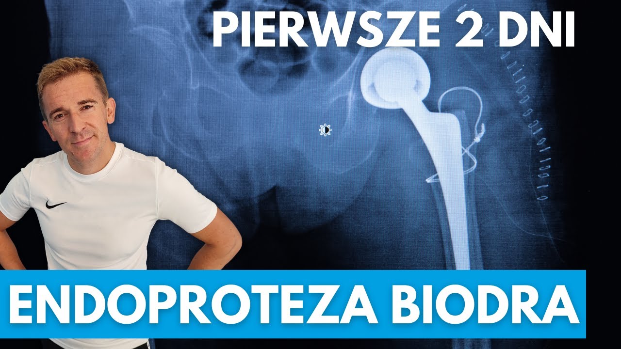 Skierowanie Na Rehabilitację Po Operacji Biodra