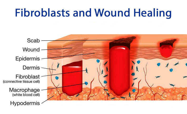 Wound Healing And The Role Of Fibroblasts Pdf