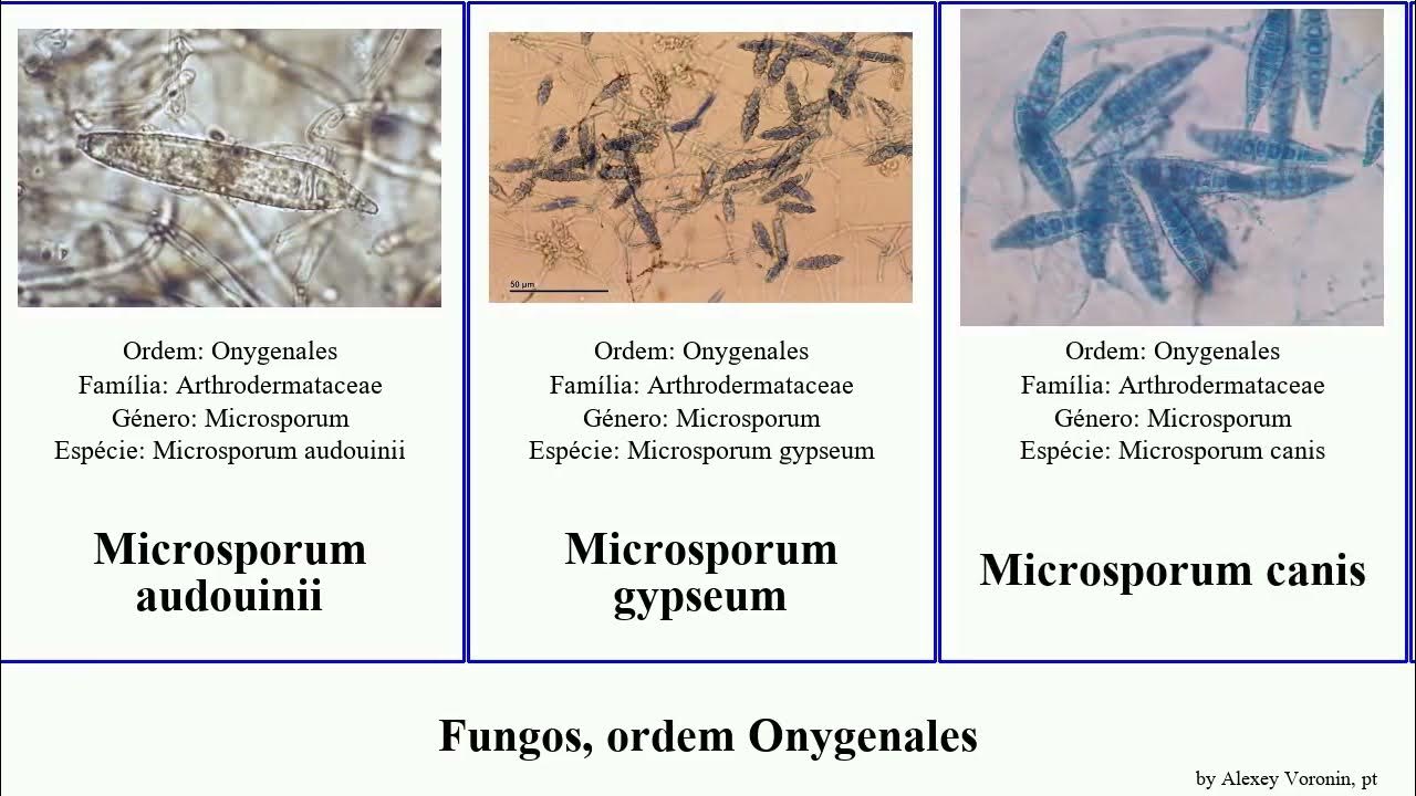 Microsporum Canis U Ludzi Leczenie