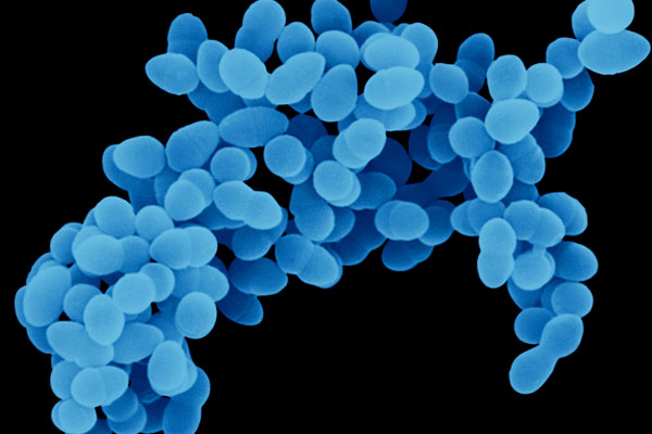 Gronkowiec leczenie i objawy - Biobalance Gronkowiec Złocisty Oporny Na Metycylinę