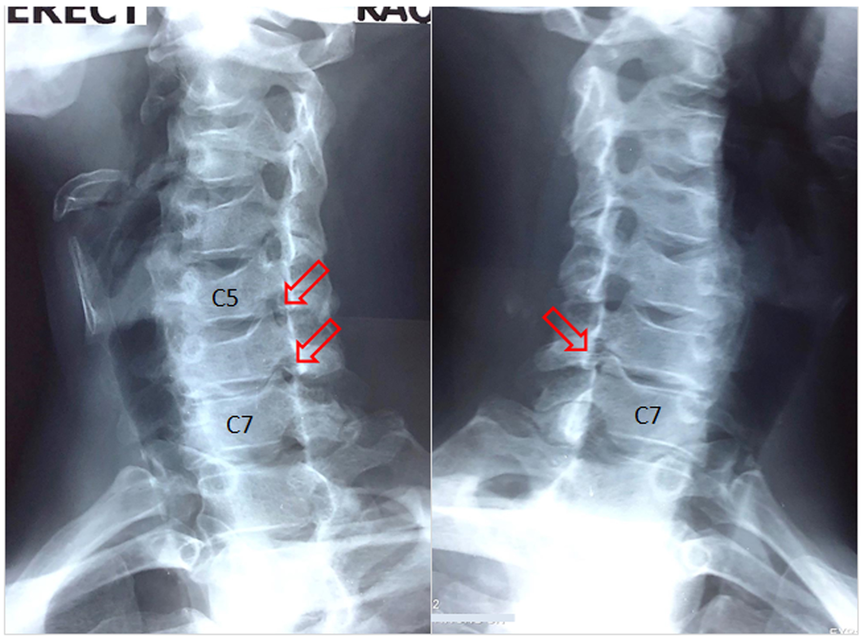 J Med Cases Ciekawość Ułatwia Czy Utrudnia życie Napisz Rozprawkę