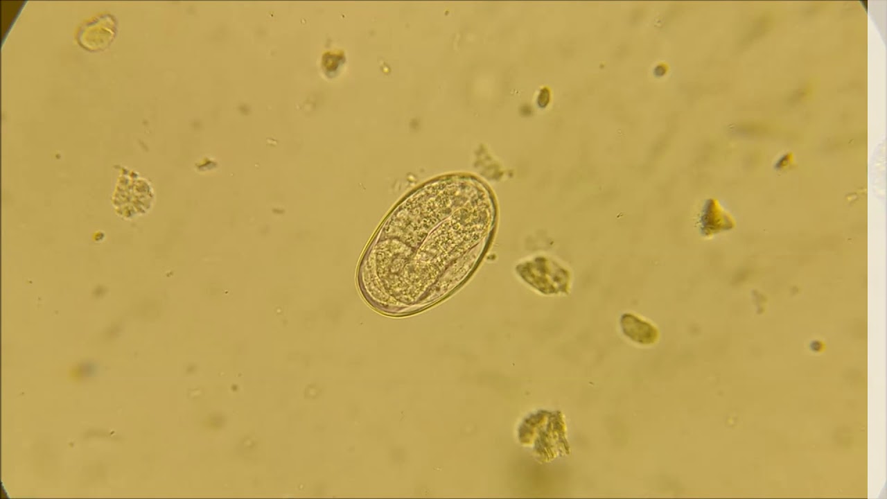 Jaja glisty kociej/Toxocara cati eggs - YouTube Jak Wyglądają Jaja Glisty Ludzkiej