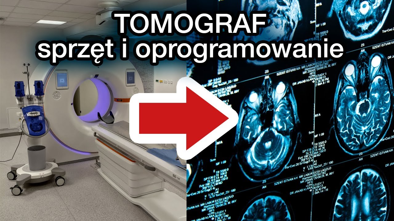 Jak działa tomografia komputerowa? - YouTube Rekonstrukcja Obrazu W Tomografii Komputerowej
