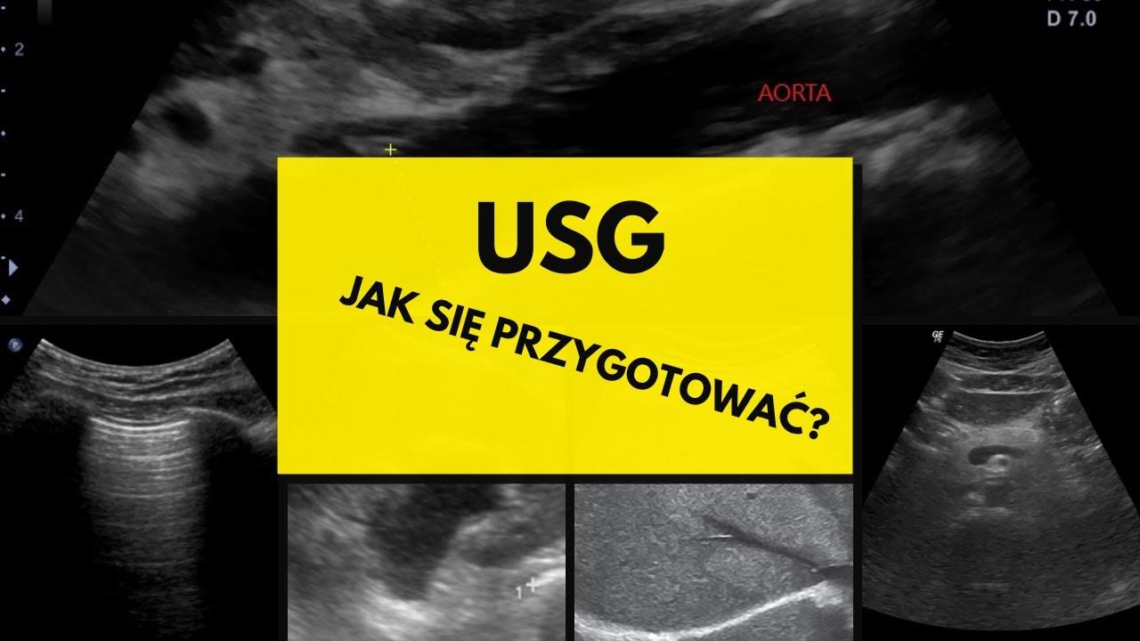 Przykładowy Opis Usg Jamy Brzusznej