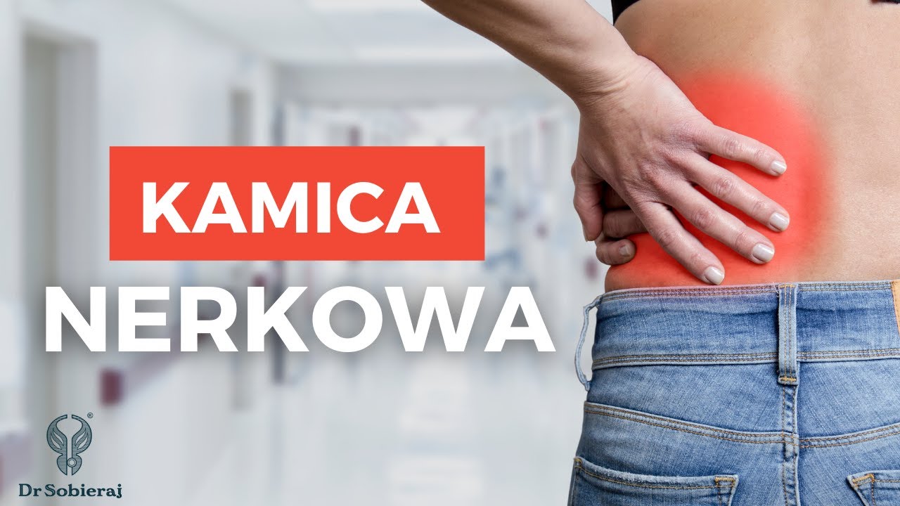 Kamica nerkowa - objawy i przyczyny - YouTube Nadczynność Przytarczyc A Kamica Nerkowa