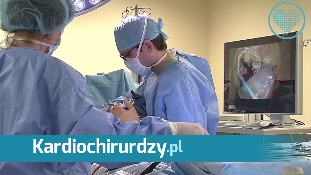 Małoinwazyjna operacja naprawy zastawki mitralnej serca - YouTube Niedrożność Zastawki Komorowo Otrzewnowej Objawy