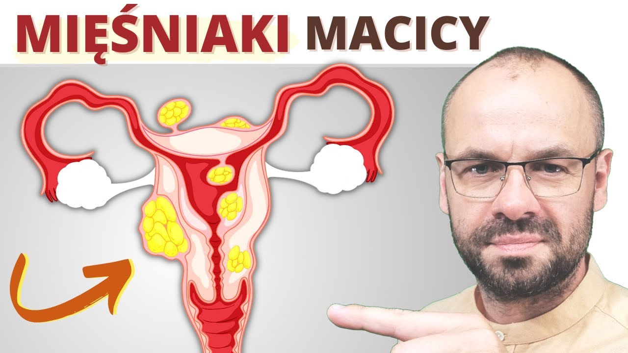 Mięśniaki macicy - zapobieganie i leczenie naturalne - YouTube Samopoczucie Przed Okresem A Ciąża