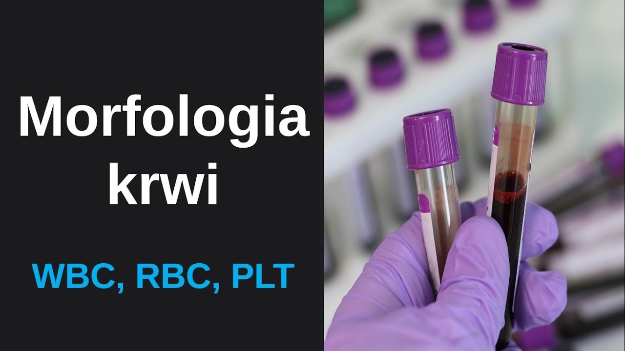 Morfologia krwi - leukocyty (WBC), erytrocyty (RBC) oraz trombocyty Ig W Morfologii Co Oznacza