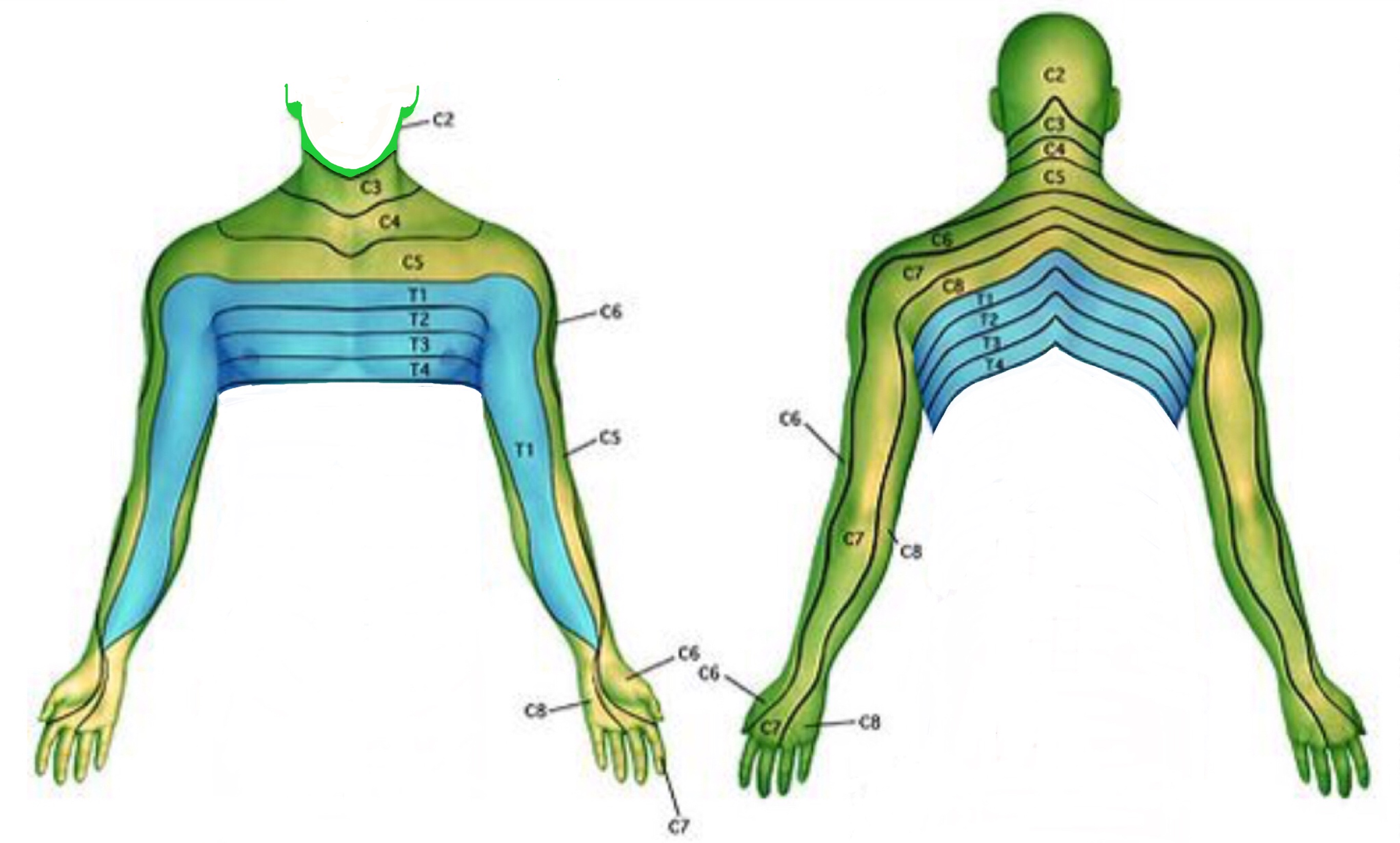 Neck and Arm Pain - Spines Dorset Drewnianą Belkę O Długości 4 8 M Rozcięto Na Dwie