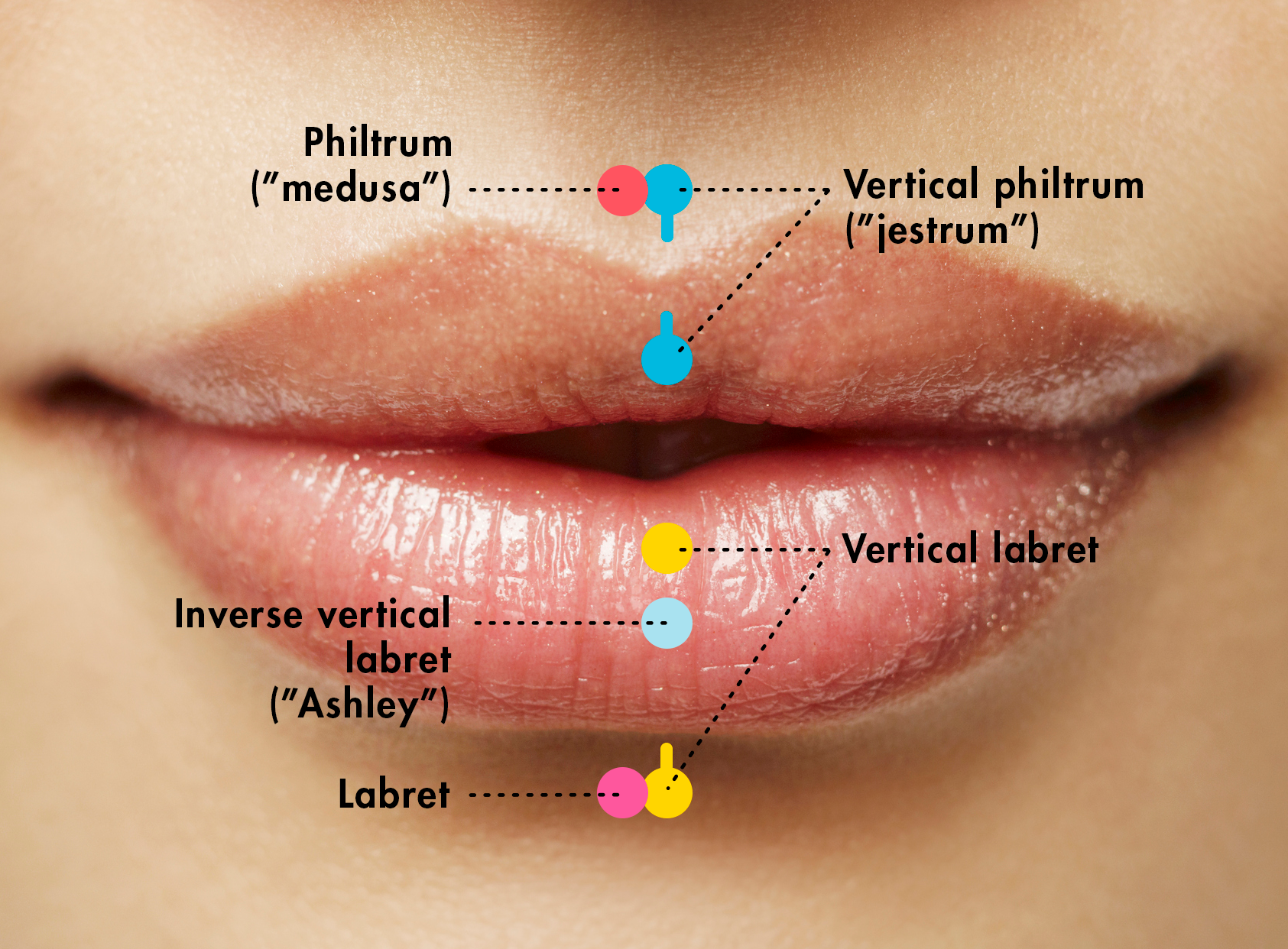 Normal Lip Piercing Healing Process - Infoupdate.org Proces Pielęgnowania Oiom Opis Przypadku