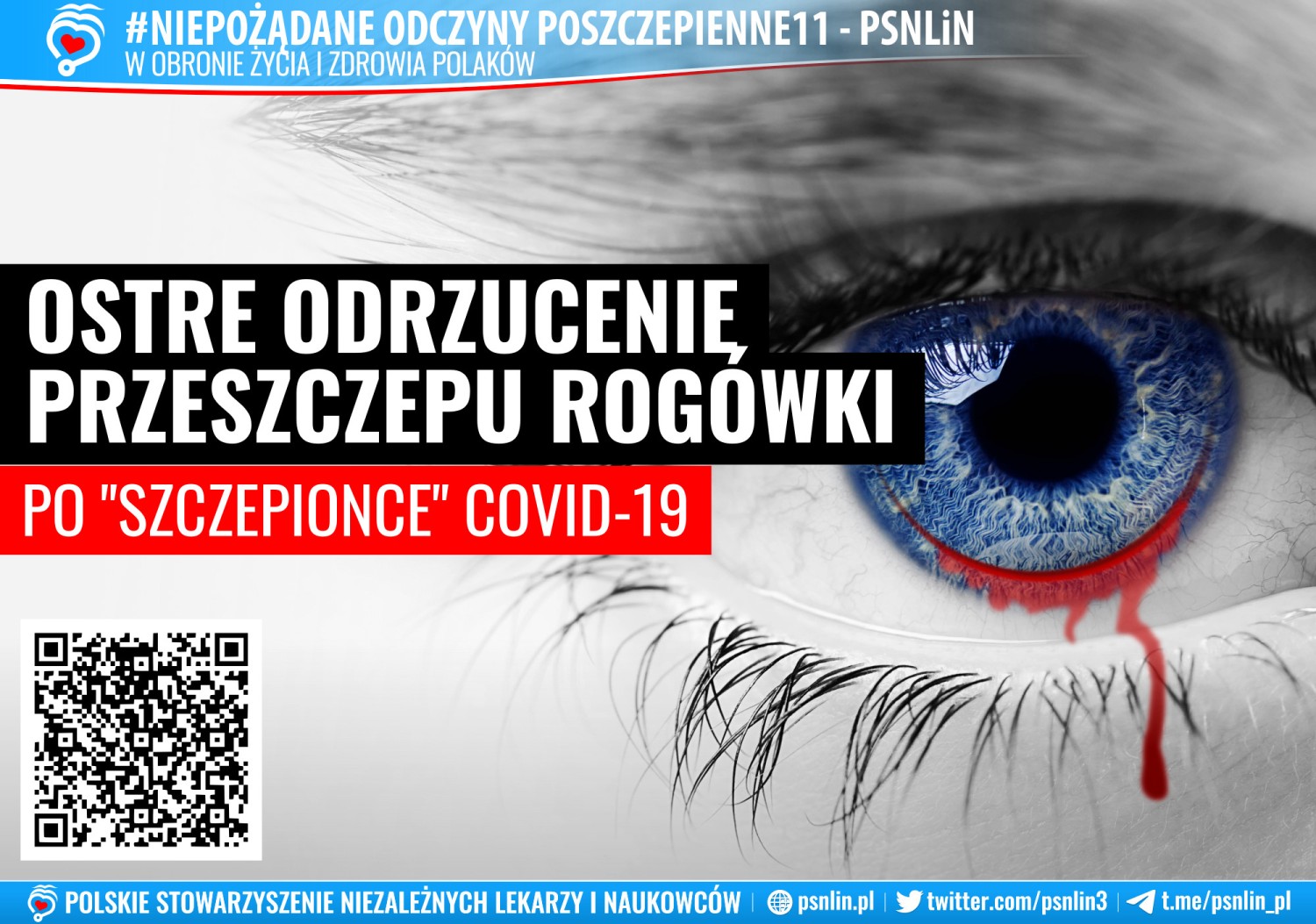 Odrzucenie Przeszczepu To Przyklad Odpornosci