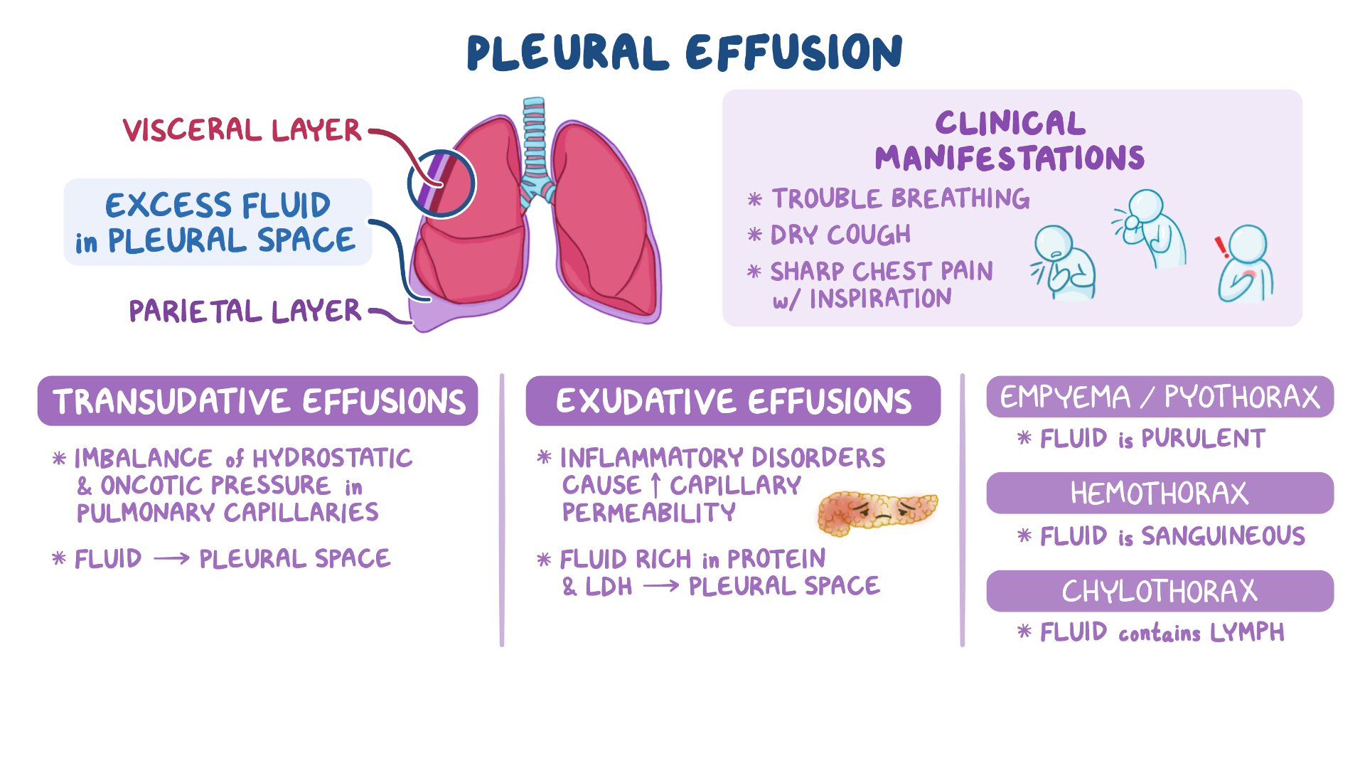 Pleural Effusion Pathophysiology Exudative Vs Transudative Pleural Effusion Mnemonic