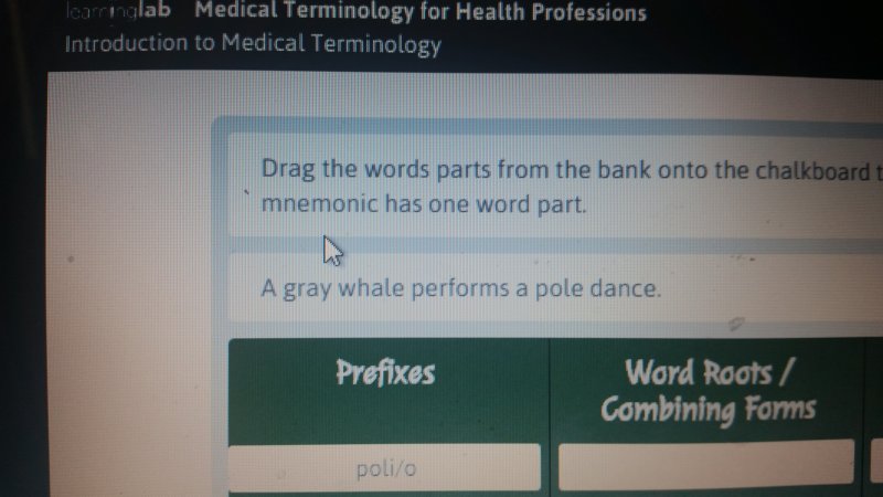 Pole dancing Gray Whale answer on pg 7 - Page 4 | BabyCenter Gray Whale Performs A Pole Dance