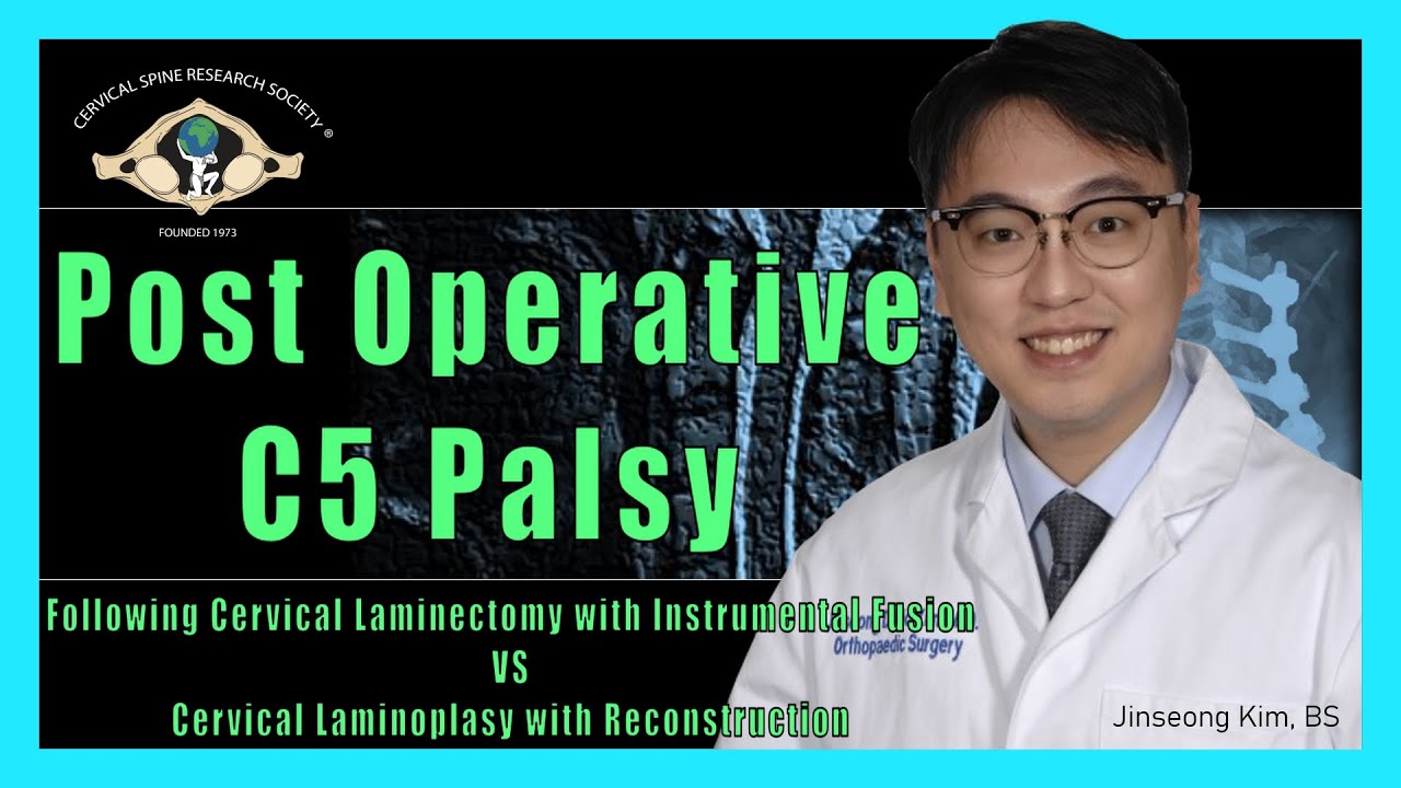 Post Operative C5 Palsy - YouTube Przesłuchanie świadka W Postępowaniu Karnym