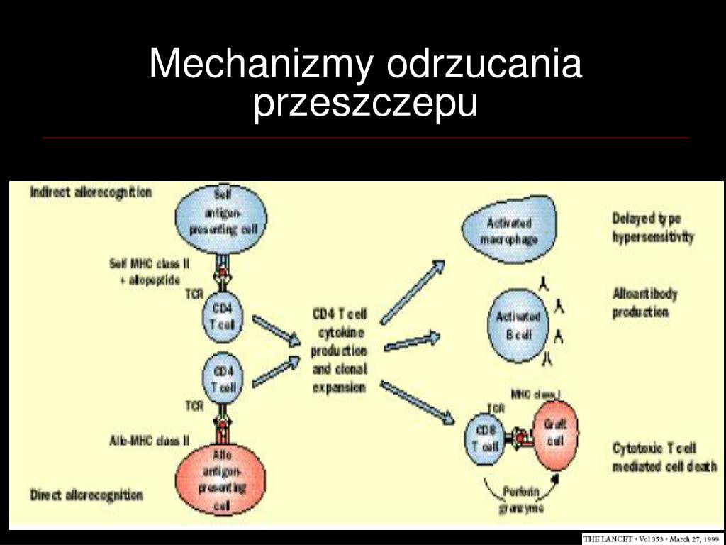 PPT - Kliniczne aspekty przeszczepiania narządów PowerPoint Odrzucenie Przeszczepu To Przyklad Odpornosci