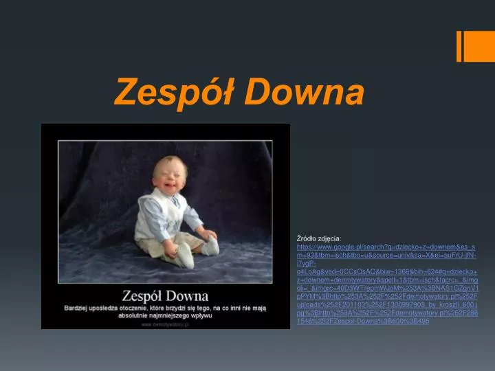 PPT - Zespół Downa PowerPoint Presentation, free download - ID:6321055 Dziecko Z Zespołem Downa Jaka To Musi Być Miłość