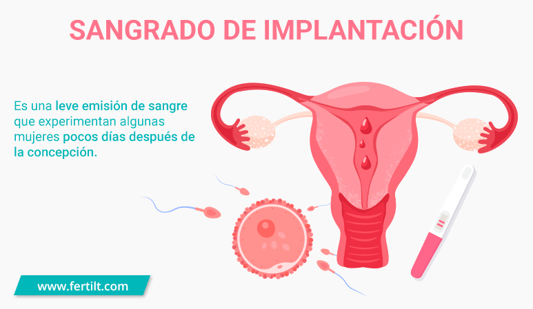 Sangrado De Implantacion Abundante Experiencias