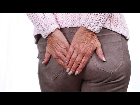 Rak odbytu - objawy, przyczyny, leczenie, rokowania - YouTube Zapalenie Odbytu U Dzieci Objawy
