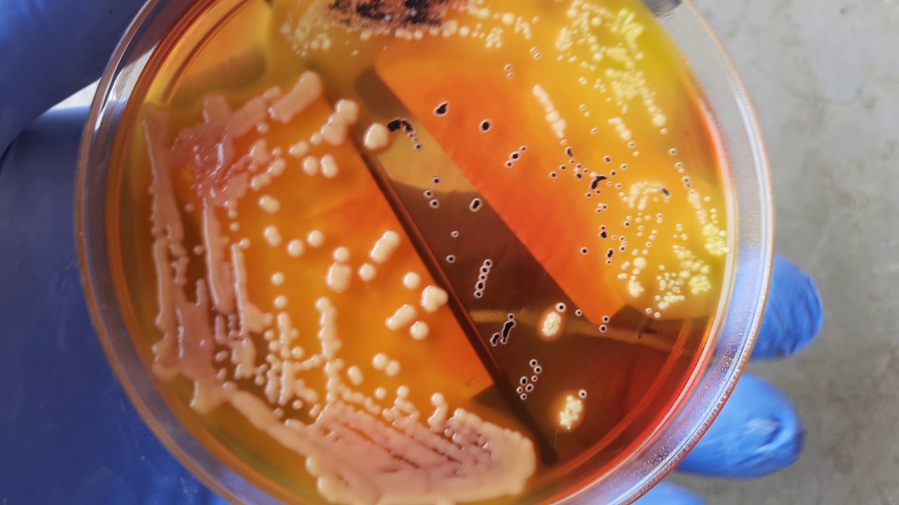 Czy Salmonella Ginie W Wysokiej Temperaturze