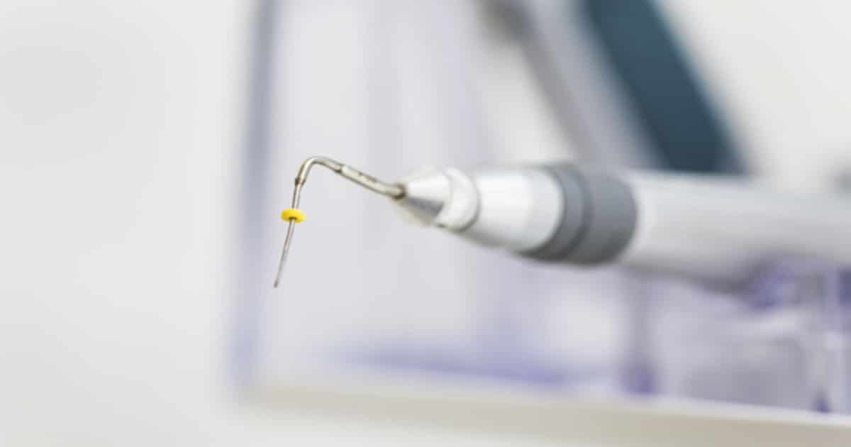 Sonda Nabers - Conheça Seus Diferentes Tipos e Funções Sonda Nabersa Do Czego Sluzy