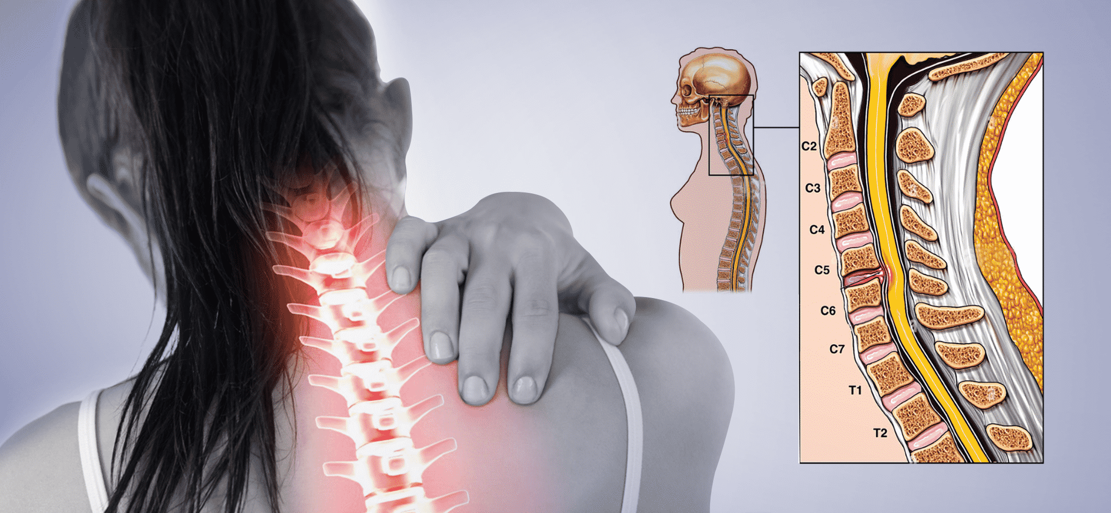 Spine Anatomy C5 C6 Maty Słomiane Na ścianę Przy łóżku