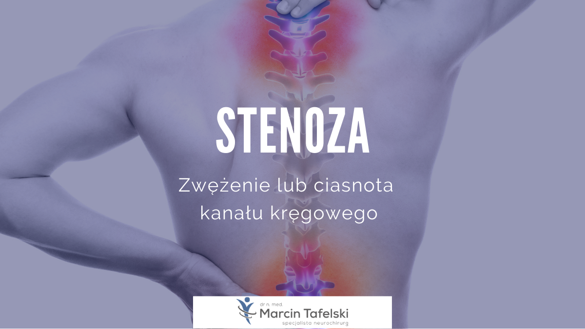 Stenoza Kanalu Kregowego A Renta