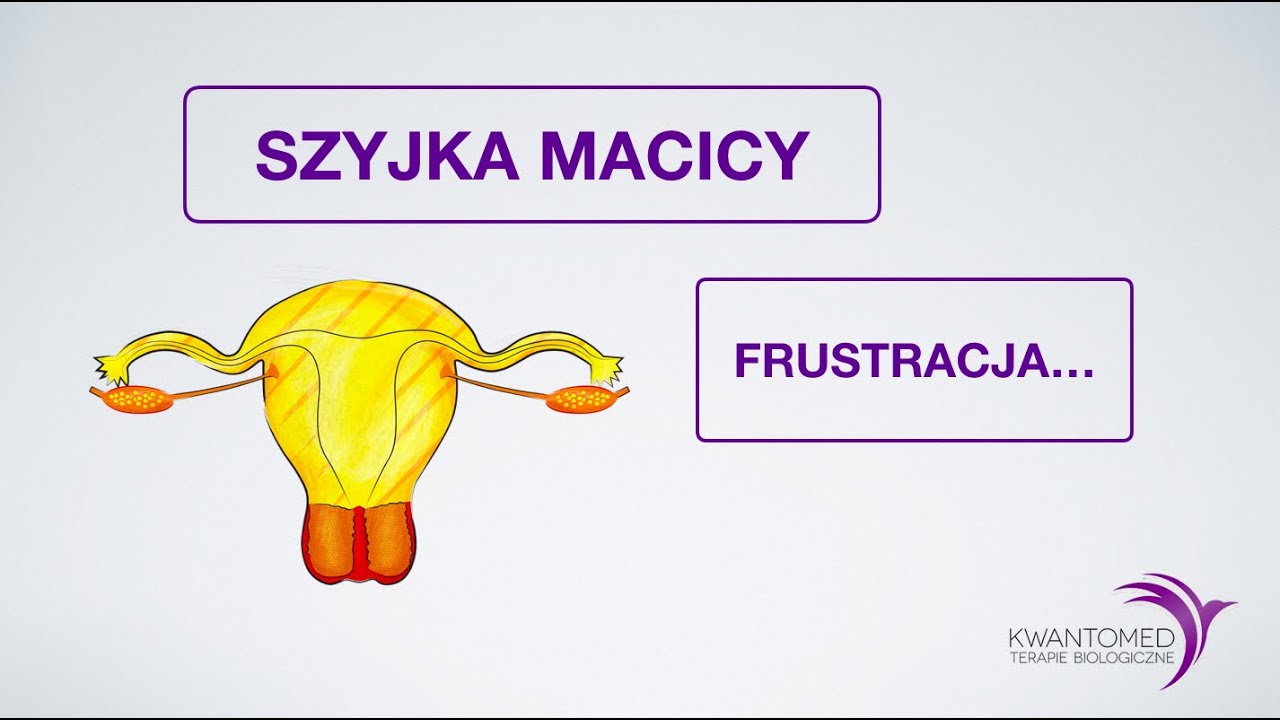 Klasyfikacja Figo Rak Trzonu Macicy